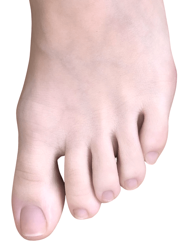 picture of one foot. showing How to Stop Toes from Curling