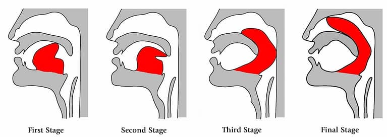 four subsequent diagrams of a face side view. showing the progression of kechari mudra exercises